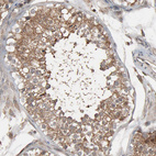 Immunohistochemical staining of human testis shows moderate cytoplasmic positivity in cells in seminiferous ducts.