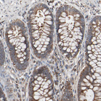 Immunohistochemical staining of human rectum shows moderate cytoplasmic positivity in cells in granular layer.