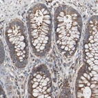 Immunohistochemical staining of human rectum shows moderate cytoplasmic positivity in cells in granular layer.