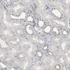 Immunohistochemical staining of human kidney shows weak cytoplasmic positivity in cells in tubules.