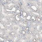 Immunohistochemical staining of human kidney shows weak cytoplasmic positivity in cells in tubules.