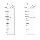 Western blot analysis using Anti-OPTN antibody HPA003279 (A) shows similar pattern to independent antibody HPA003360 (B).