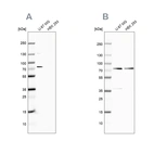 Western blot analysis using Anti-OPTN antibody HPA003279 (A) shows similar pattern to independent antibody HPA003360 (B).