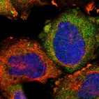 Immunofluorescent staining of human cell line A-431 shows localization to cytosol.