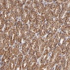 Anti-PHB Antibody