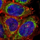 Immunofluorescent staining of human cell line A-431 shows localization to mitochondria & vesicles.