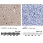 Anti-ALDOC Antibody