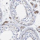 Immunohistochemical staining of human testis shows moderate cytoplasmic positivity in Leydig cells.