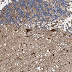 Immunohistochemical staining of human cerebellum shows strong cytoplasmic positivity in Purkinje cells.