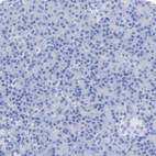 Immunohistochemical staining of human pancreas shows no positivity in exocrine glandular cells as expected.