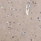Immunohistochemical staining of human cerebral cortex shows strong cytoplasmic positivity in a subset of glial cells.