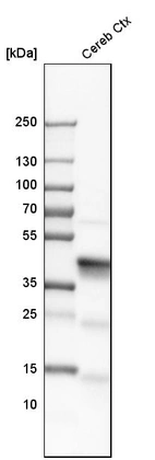 Western blot analysis in human cerebral cortex tissue.