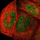 Immunofluorescent staining of human cell line A-431 shows localization to nucleus, nucleoli fibrillar center & cytosol.