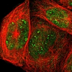 Immunofluorescent staining of human cell line A-431 shows localization to nucleus, nucleoli fibrillar center & cytosol.