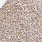 Anti-WSB1 Antibody