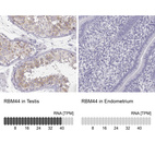 Anti-RBM44 Antibody