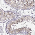 Immunohistochemical staining of human testis shows high expression.