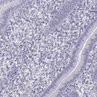 Immunohistochemical staining of human endometrium shows low expression as expected.