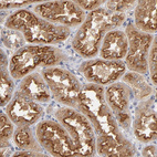 Anti-ASB8 Antibody