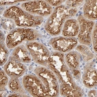 Immunohistochemical staining of human kidney shows strong cytoplasmic positivity in cells in tubules.