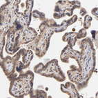 Anti-ASB8 Antibody