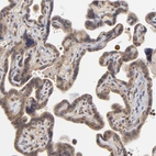 Immunohistochemical staining of human placenta shows moderate cytoplasmic positivity in trophoblastic cells.