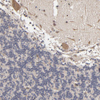 Anti-ASB8 Antibody