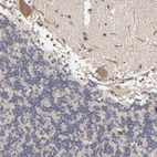 Immunohistochemical staining of human cerebellum shows moderate cytoplasmic positivity in Purkinje cells.