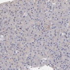 Anti-ASB7 Antibody