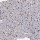 Immunohistochemical staining of human pancreas shows low expression as expected.