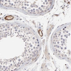 Immunohistochemical staining of human testis shows high expression.