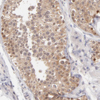 Anti-UBE2E3 Antibody