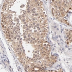 Immunohistochemical staining of human testis shows moderate cytoplasmic and nuclear positivity in cells in seminiferous ducts.