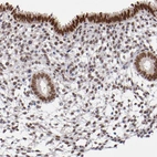 Immunohistochemical staining of human endometrium shows strong nuclear positivity in glandular cells.