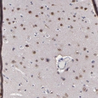 Immunohistochemical staining of human cerebral cortex shows moderate cytoplasmic and nuclear positivity in neurons.