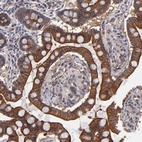 Anti-ZNF780B Antibody