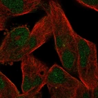Immunofluorescent staining of human cell line RH-30 shows localization to nucleus & centrosome.