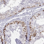 Anti-RHOXF2 Antibody