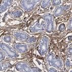 Immunohistochemical staining of human breast shows moderate cytoplasmic positivity in stromal cells.