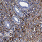 Immunohistochemical staining of human endometrium shows moderate cytoplasmic positivity in stromal cells.