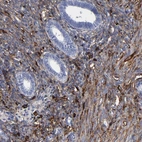 Immunohistochemical staining of human endometrium shows moderate cytoplasmic positivity in stromal cells.