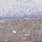 Immunohistochemical staining of human uterine cervix shows moderate cytoplasmic positivity in stromal cells.