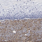 Immunohistochemical staining of human uterine cervix shows moderate cytoplasmic positivity in stromal cells.