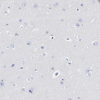 Immunohistochemical staining of human cerebral cortex shows no positivity in neurons as expected.