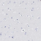 Immunohistochemical staining of human cerebral cortex shows no positivity in neurons as expected.