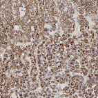 Anti-TXNRD2 Antibody