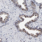 Immunohistochemical staining of human prostate shows strong granular cytoplasmic positivity in glandular cells.