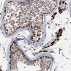 Immunohistochemical staining of human testis shows strong granular cytoplasmic positivity in Spermatogonia and Leydig cells.