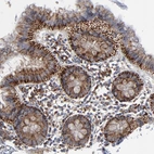 Immunohistochemical staining of human colon shows strong granular cytoplasmic positivity in glandular cells.