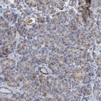 Anti-TXNRD2 Antibody